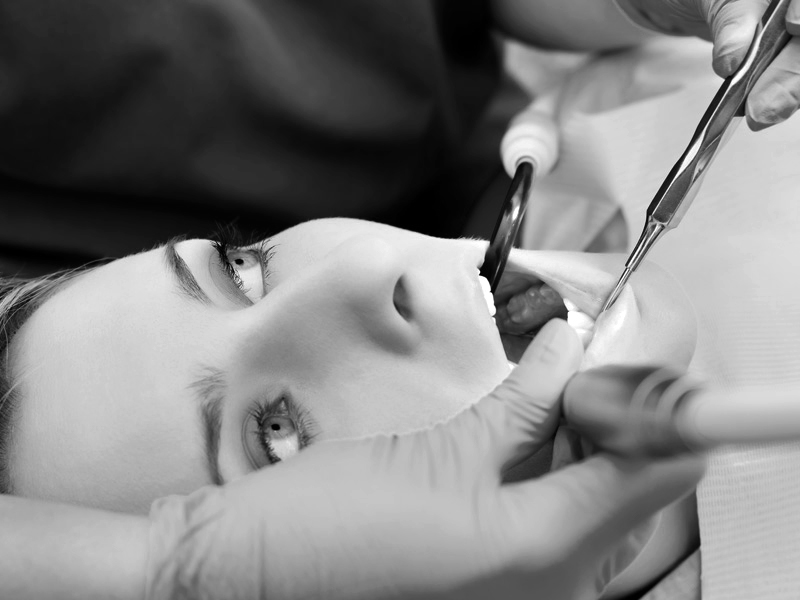 4 Signs You Need to Go to an Emergency Dentist Right Away